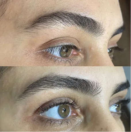 Sobrancelha antes e depois do design, resultado 2