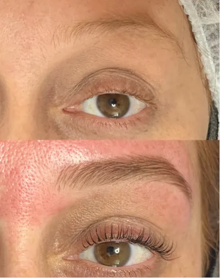 Sobrancelha antes e depois do design, resultado 3